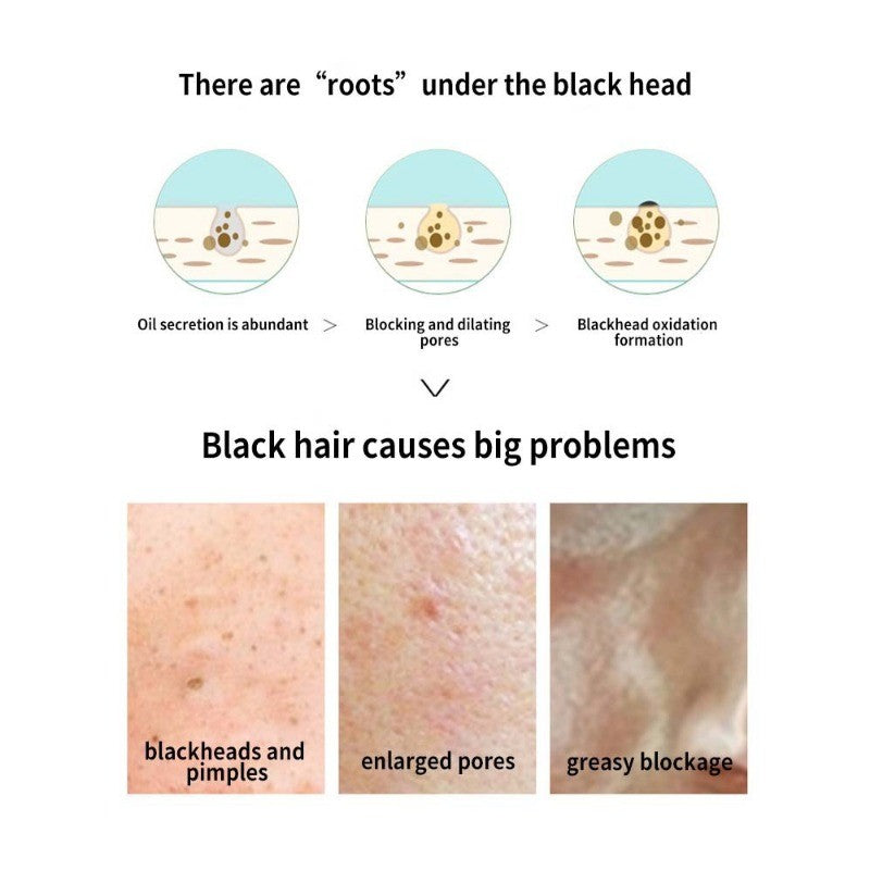 Blackhead Removal Nose Strips - Deep Cleansing Pore Treatment for Clearer Skin