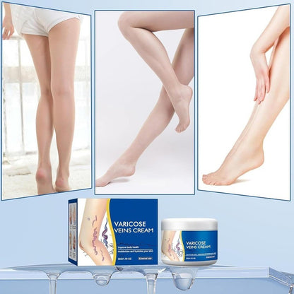 Leg Vein Comfort Cream for Soothing Relief and Skin Moisturizing Care