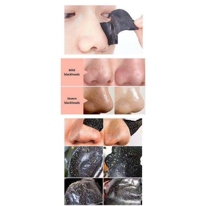 Professional 3-Step Blackhead Solution - For Visibly Cleaner and Smoother Skin