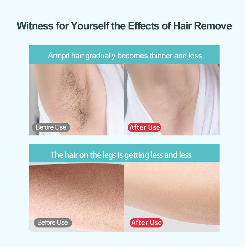 Electric Handheld Beauty Device for Face, LED Photon Therapy Skin Care