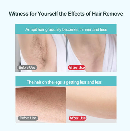 Electric Handheld Beauty Device for Face, LED Photon Therapy Skin Care