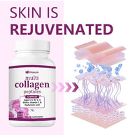 Sinpuyle Multi Collagen Peptides Complex Daily Collagen Supplement Capsules