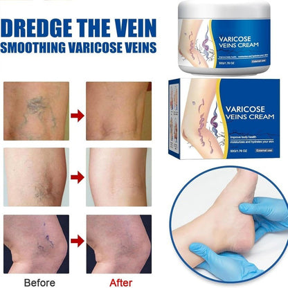Leg Vein Comfort Cream for Soothing Relief and Skin Moisturizing Care