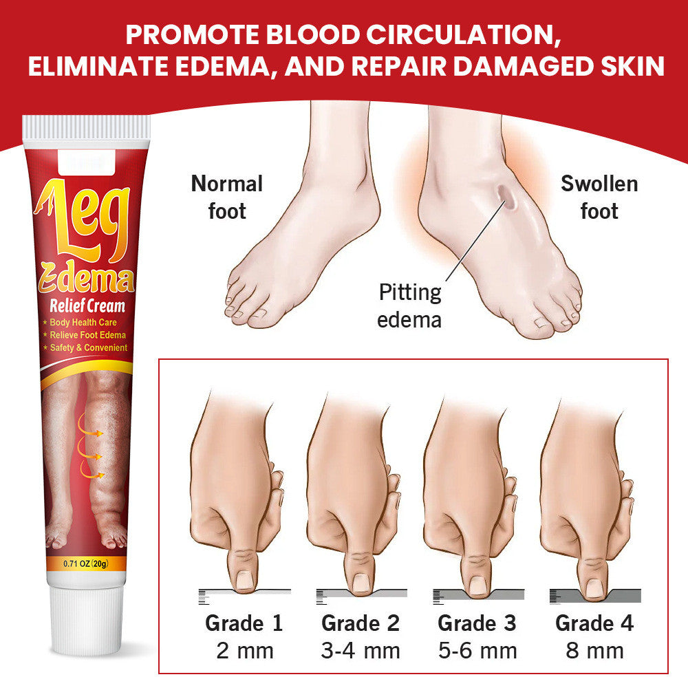 1-6PCS Anti Edema Cream, Remove Arm Leg Swelling Pain Relief Ointment 20g US New