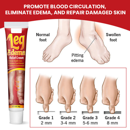 1-6PCS Anti Edema Cream, Remove Arm Leg Swelling Pain Relief Ointment 20g US New