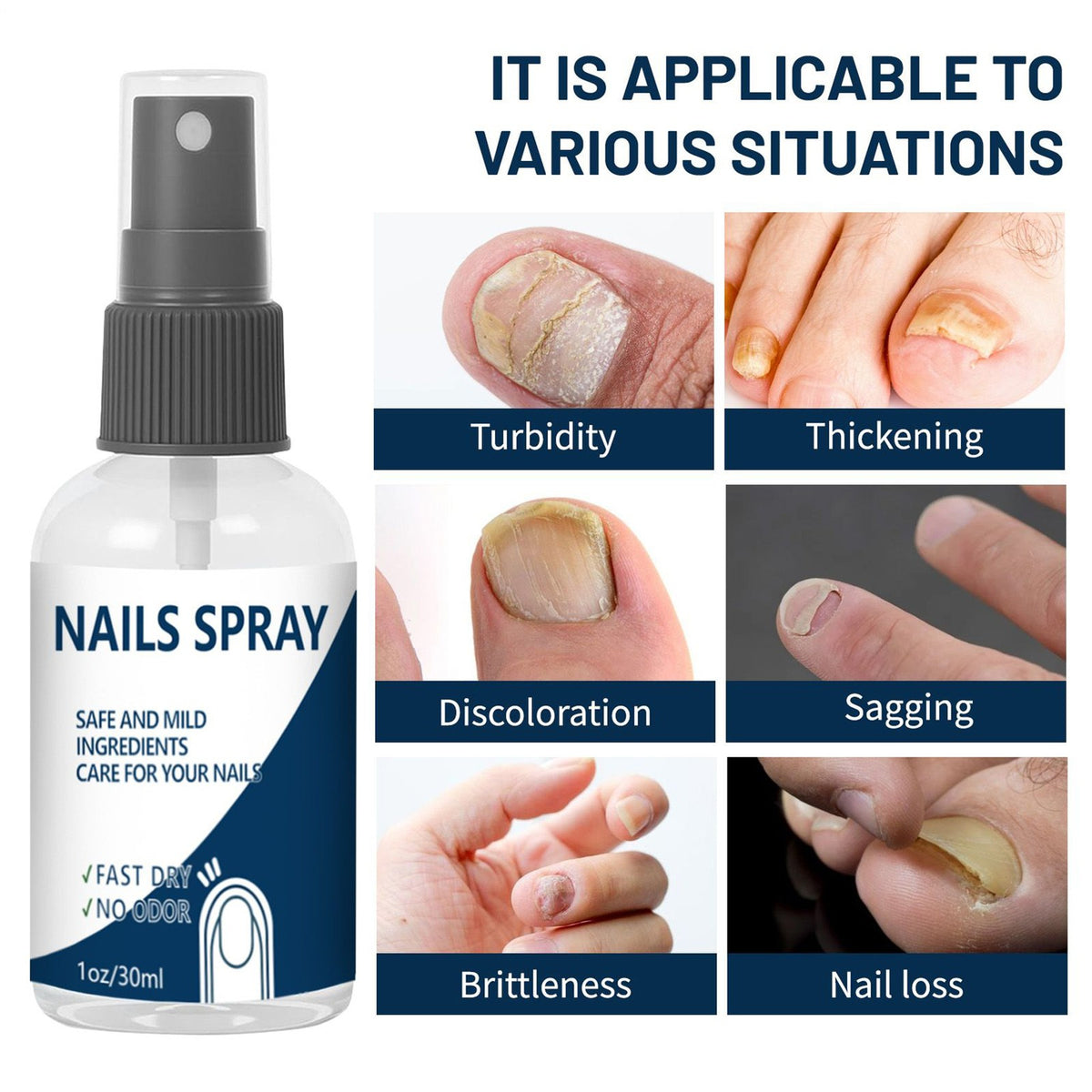 3Pack Blinzador Nails Spray Fingernails Nutrition Toenail Care Supplies