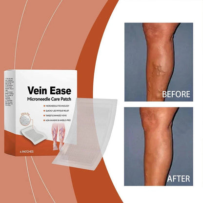 Varicose Vein Microneedle Patch Relieve Leg Swelling External Invisible Patch