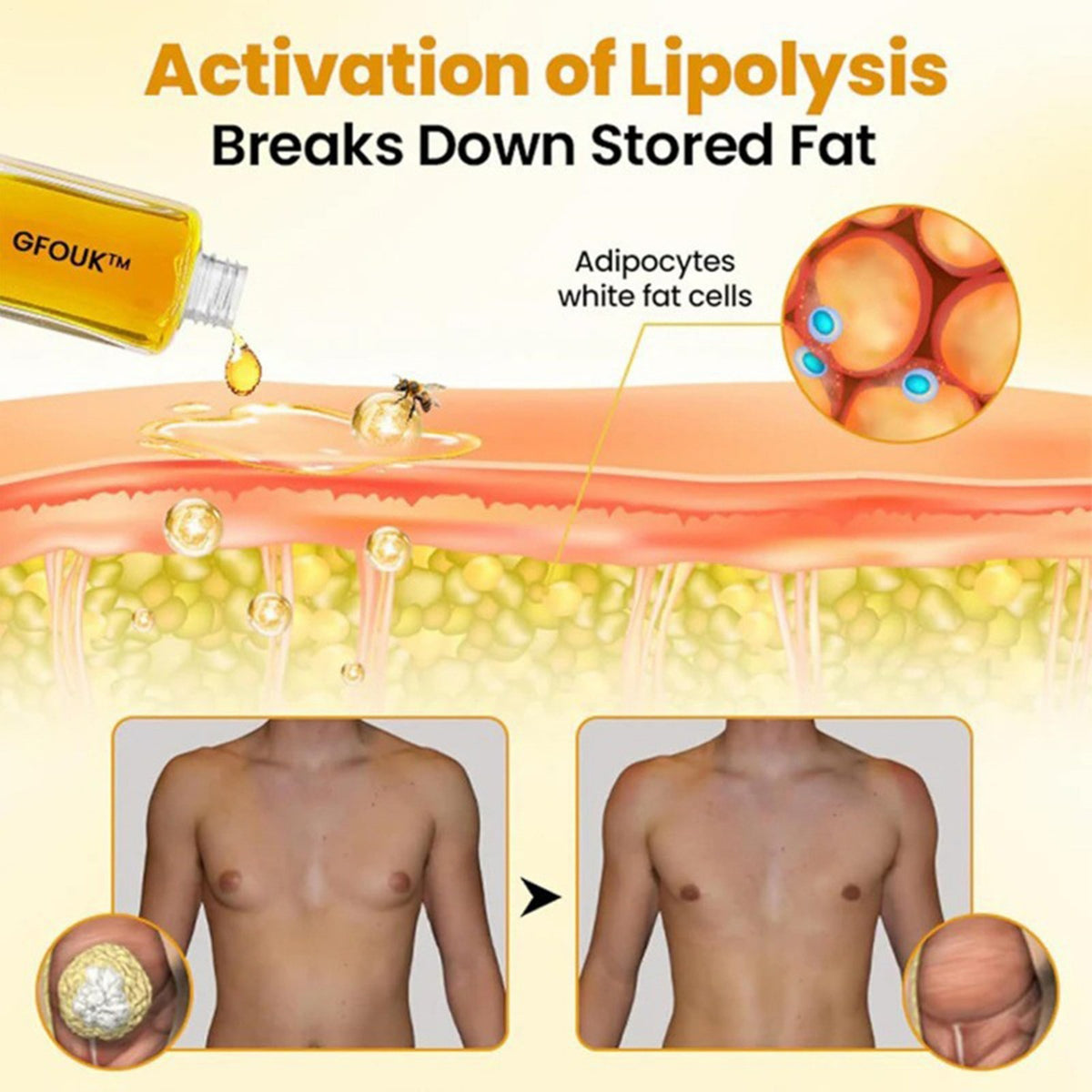 Bee Venom Gynecomastia Oil,Chest Muscles for Strengthen The Chest Muscles