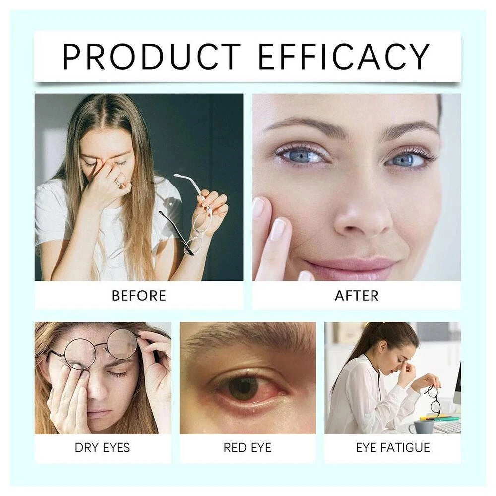 Nano Eye Drops Serum|Natural Nano Lubricant Eye Drop for Dry Eye Presbyopia