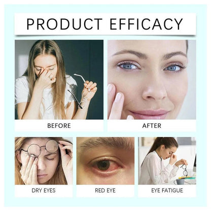 Nano Eye Drops Serum|Natural Nano Lubricant Eye Drop for Dry Eye Presbyopia
