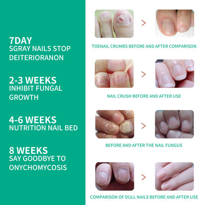 1-10PCS New Kerassentials Toenail Treatment Oil, Kerassentials for Toenail US