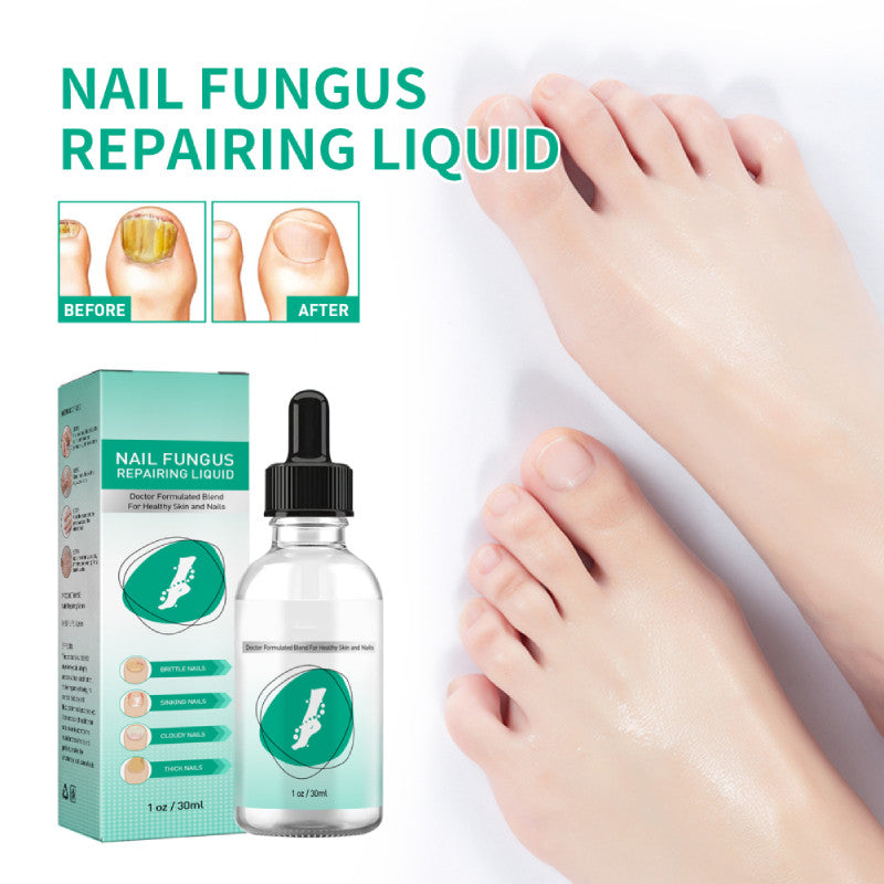 1-10PCS New Kerassentials Toenail Treatment Oil, Kerassentials for Toenail US