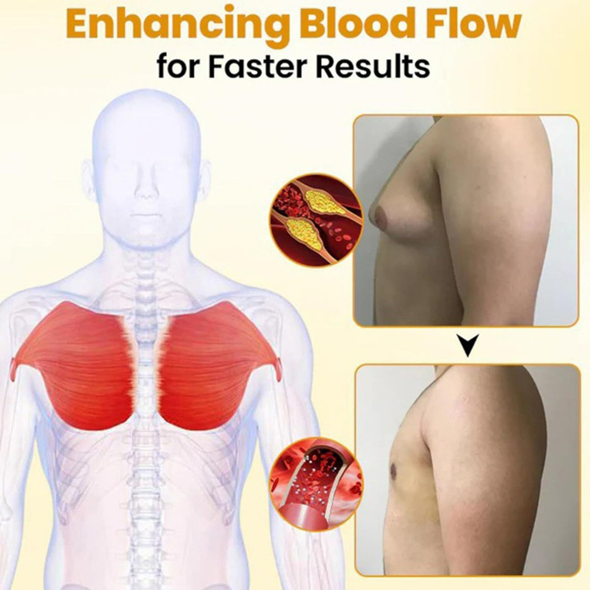 Bee Venom Gynecomastia Oil,Chest Muscles for Strengthen The Chest Muscles