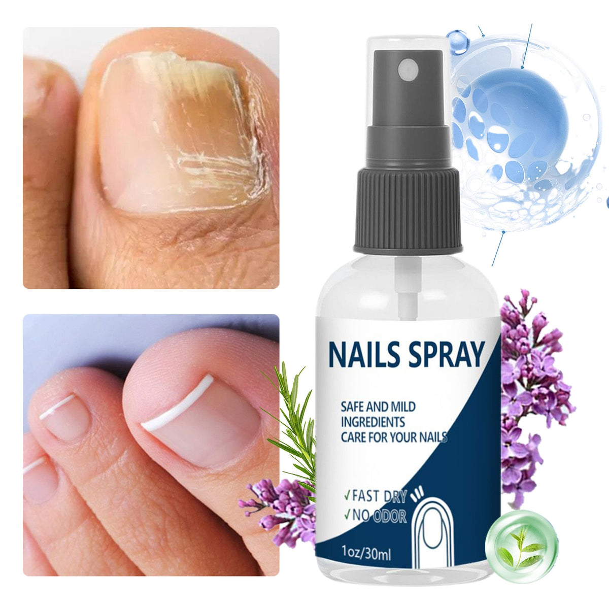 3Pack Blinzador Nails Spray Fingernails Nutrition Toenail Care Supplies